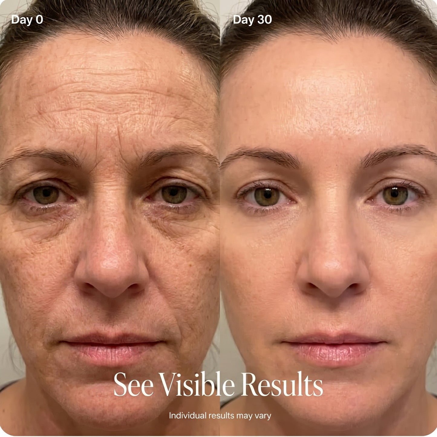 Beautrol™ EyeLift Microcurrent Therapy Wand