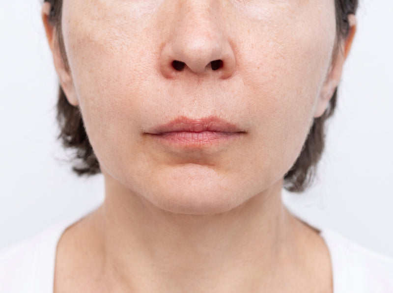 After